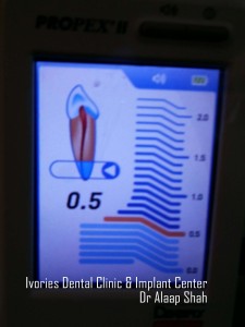 Use of apex locators